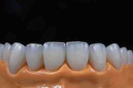 satın al Yüksek şeffaflıklı estetik zirkonya taçları doğal görünümle tam uyumlu Çevrimiçi üretim