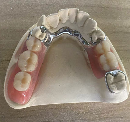 satın al Güvenilir Gümüş Metal Çerçeve Diş Dişleri Özelleştirilebilir Tasarımla Korozyona Direnci Çevrimiçi üretim