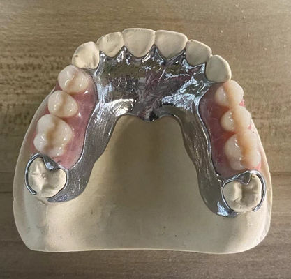 Yüksek Güçlü Atma Metal Kısmi Diş Dişleri 3D Baskı ile