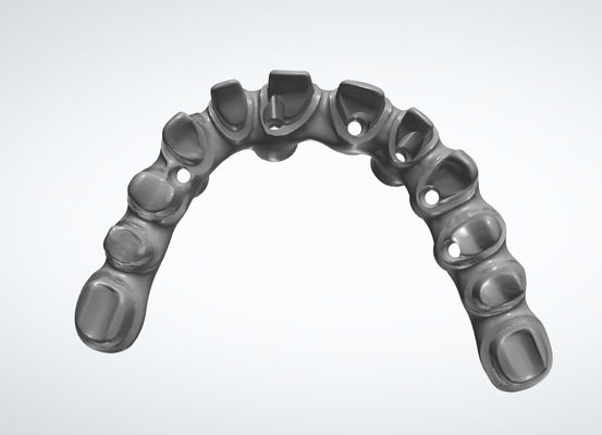 Diş Laboratuvarı Taç Diş CAD CAM Sistemleri Diş Restorasyonları için Özelleştirilebilir