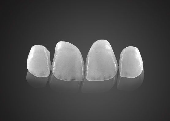IPS 0.2mm Ultra İnce Emax Yaprakları Yüksek Güçlü leke Direnci