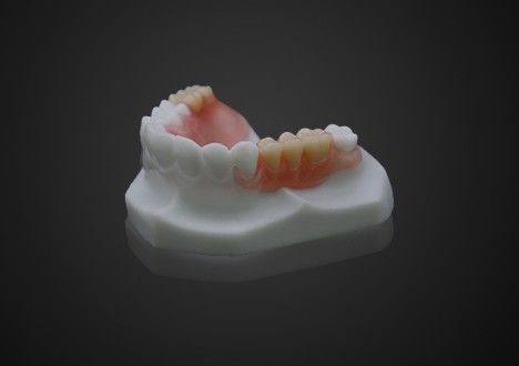 Hafif Konforlu Valplast Kısmi Diş Dişleri Temizlik kolay Yüksek Şeffaflık