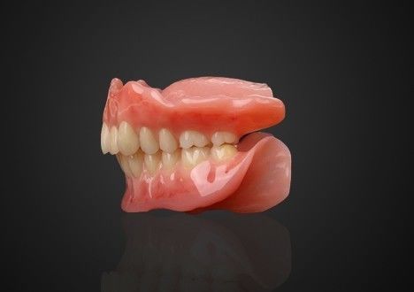 Acrylic tabanlı kısmi diş protezi çıkarılabilir ve rahat