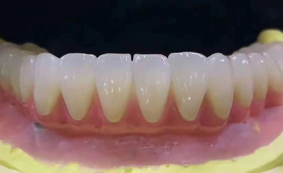 Kişisel Dental Zirconia Diş Tacı Yüksek Hassasiyetle Lekelere Dirençli