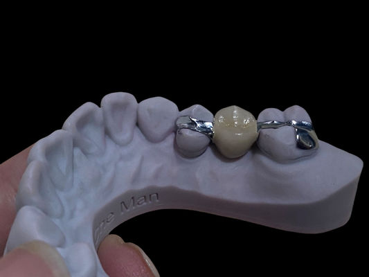 Tam Beyaz Uzun Sürekli Maryland Köprüsü Dental Restorasyon için Özelleştirilebilir
