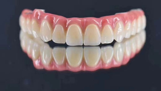 Diş Laboratuvarı Özel İmplant Desteklenmiş Metal Taç Doğal Uzun süreli istikrar arıyor