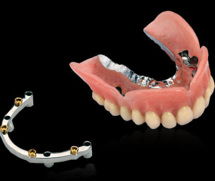 Yumuşak cilalanmış yüzey ile tutulan, öğütülmüş titanyum diş implantı çubuk vida